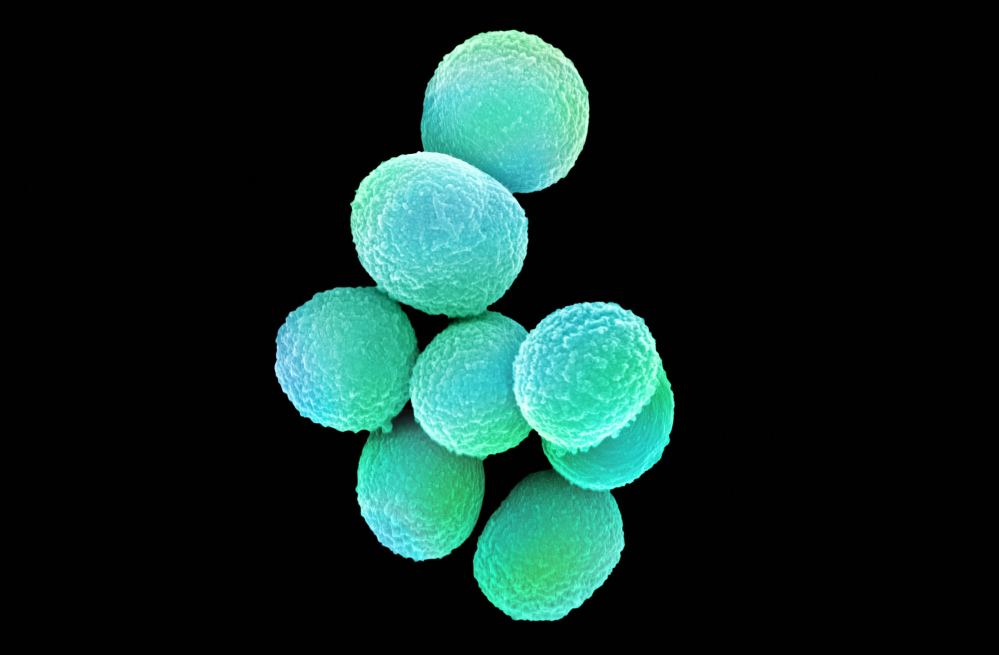 Bildet viser  MRSA (meticillin­resistente gule stafylokokker).