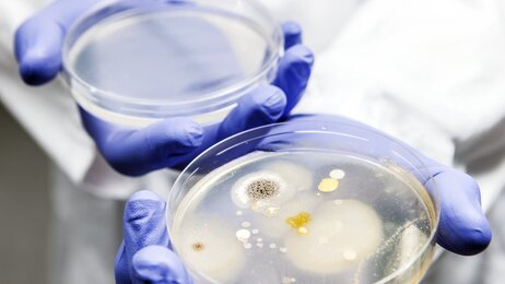 Bildet viser petridisker med bakterievekster.