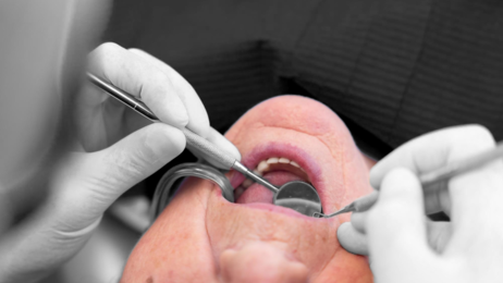 Bilde viser pasient hos tannlege