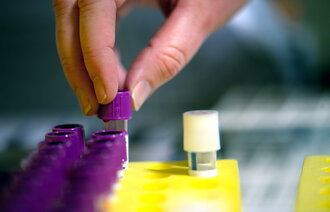 En person setter blodprøver i et stativ