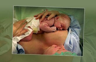 Bildet viser en nyfødt baby som ligger på brystet til moren og ammes