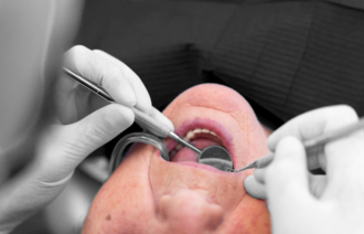 Bilde viser pasient hos tannlege