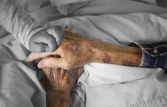 Bildet viser en eldre pasient med blåmerker på armene.