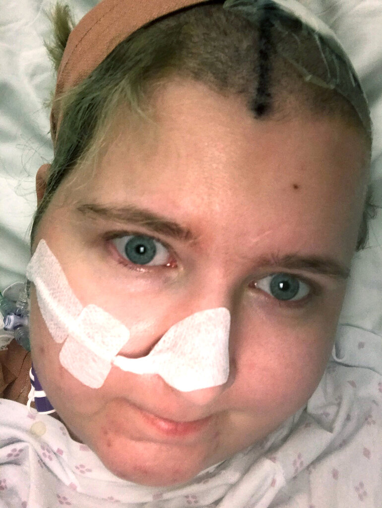 Bildet viser Madelaine Odland etter operasjonen