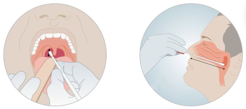 Illustrasjonen viser hvordan koronatest skal tas, i svelg og nese.
