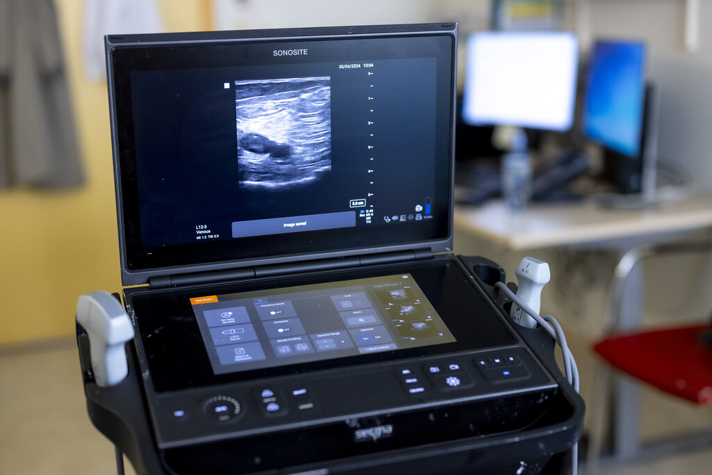 Bildet viser ultralydapparetet.