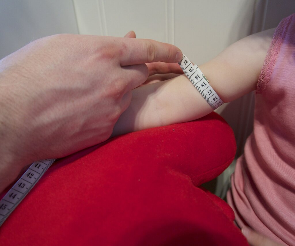 Bildet viser voksne hender som måler tykkelsen på et barns overarm med et målebånd