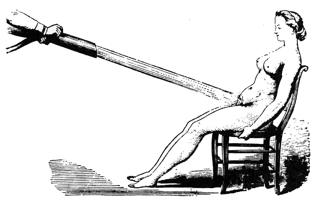 Hysteribehandling Illustrasjonen er en sort-hvitt tegning fra rundt 1860 av en kvinne som blir behandlet for hysteri med en kraftig vannstråle rettet mot underlivet