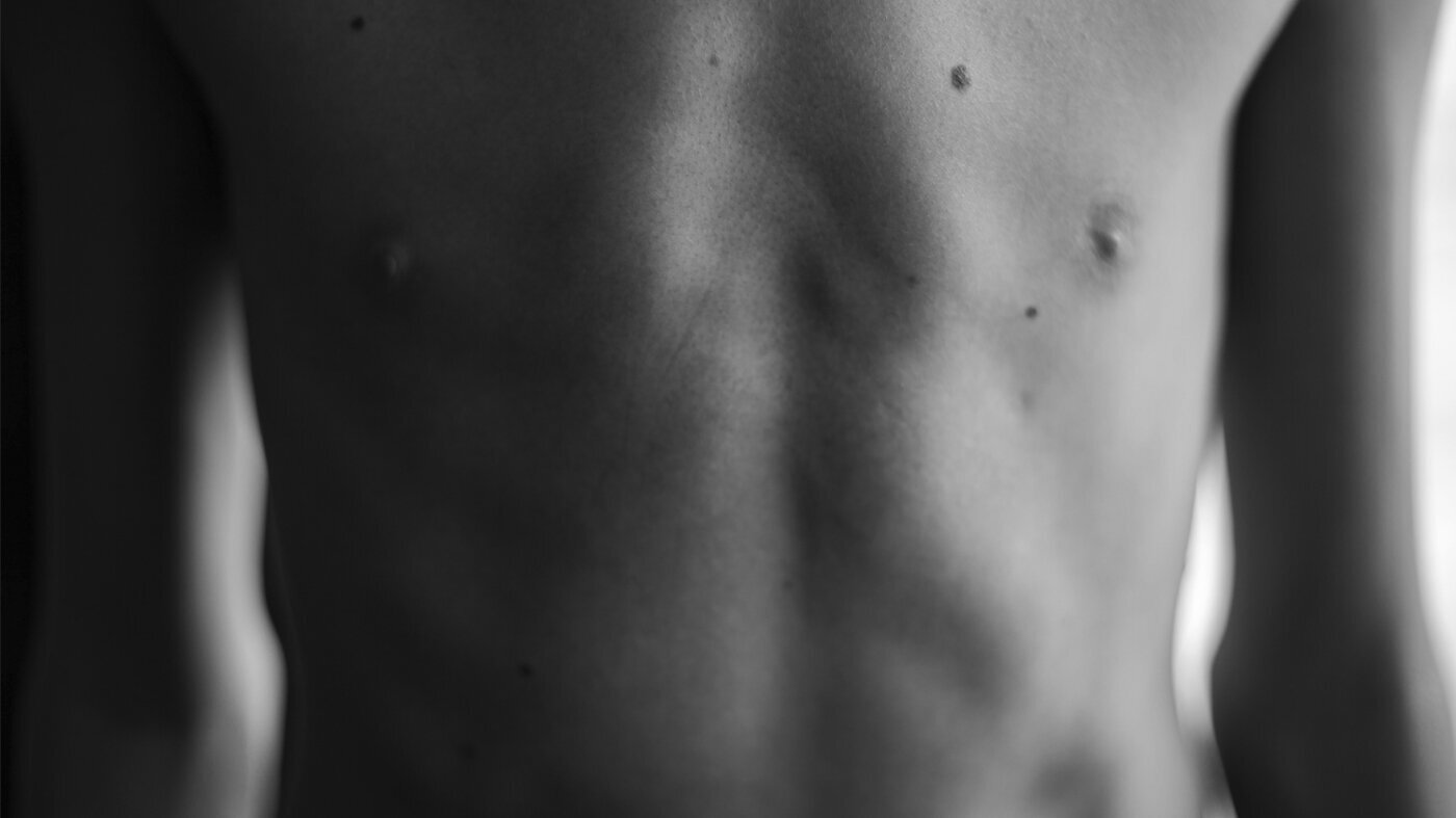 Seksualitet Naken guttebrystkasse