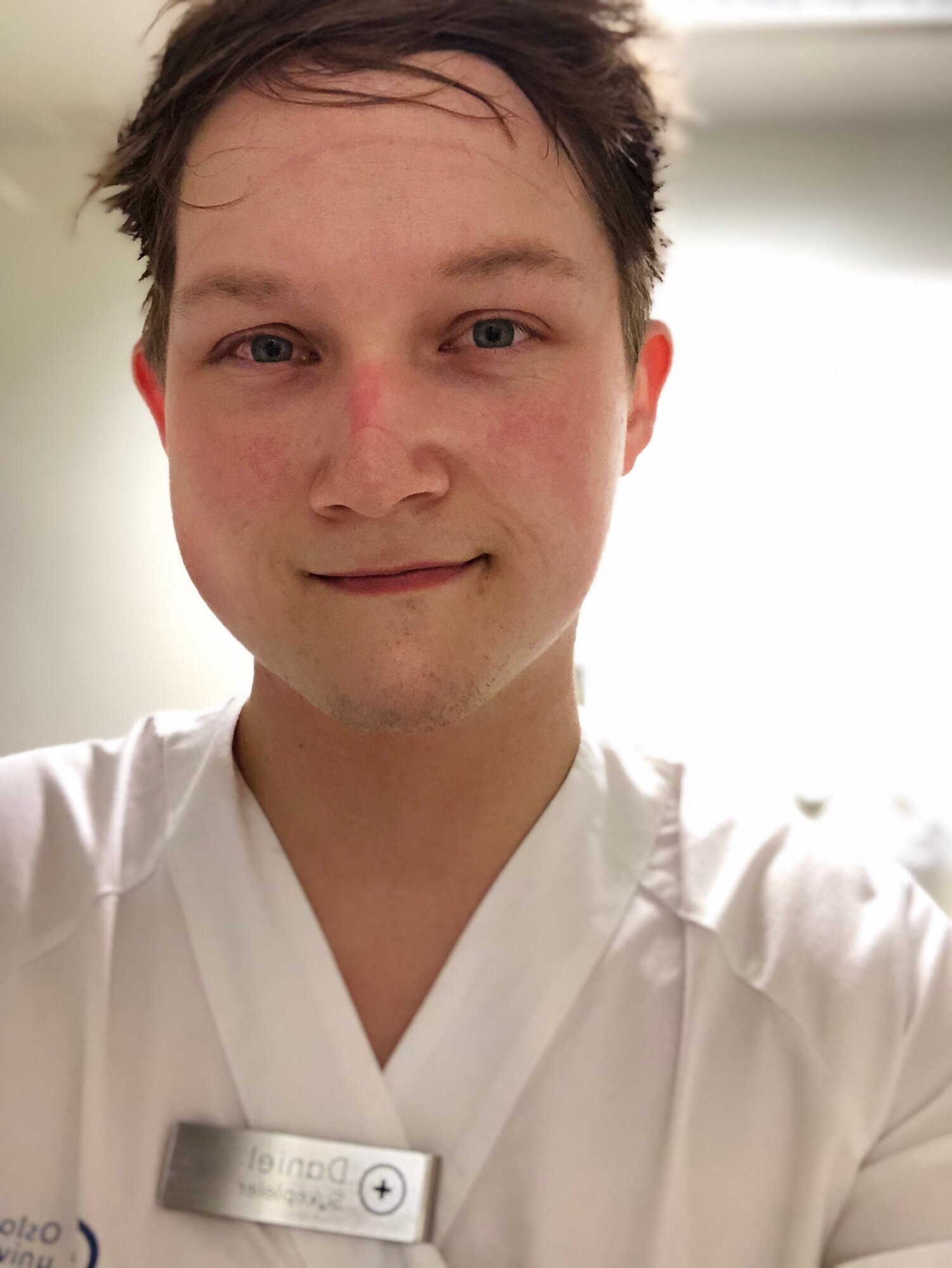 Daniel Hunstad Bildet viser Daniel Hunstad med merker i ansiktet etter maskebruk.