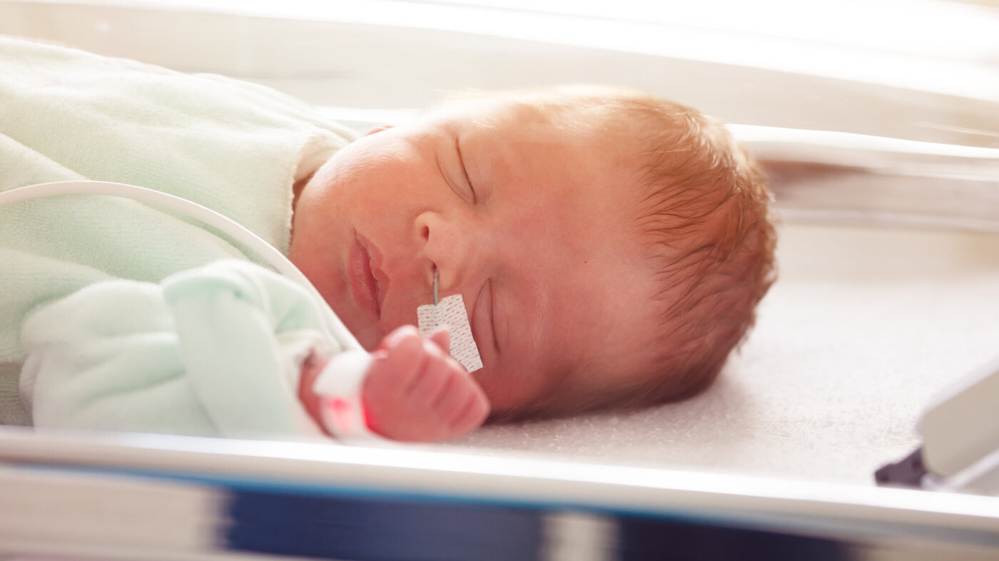 Spedbarn på intensivavdelingen Bildet viser en baby på intensivavdelingen