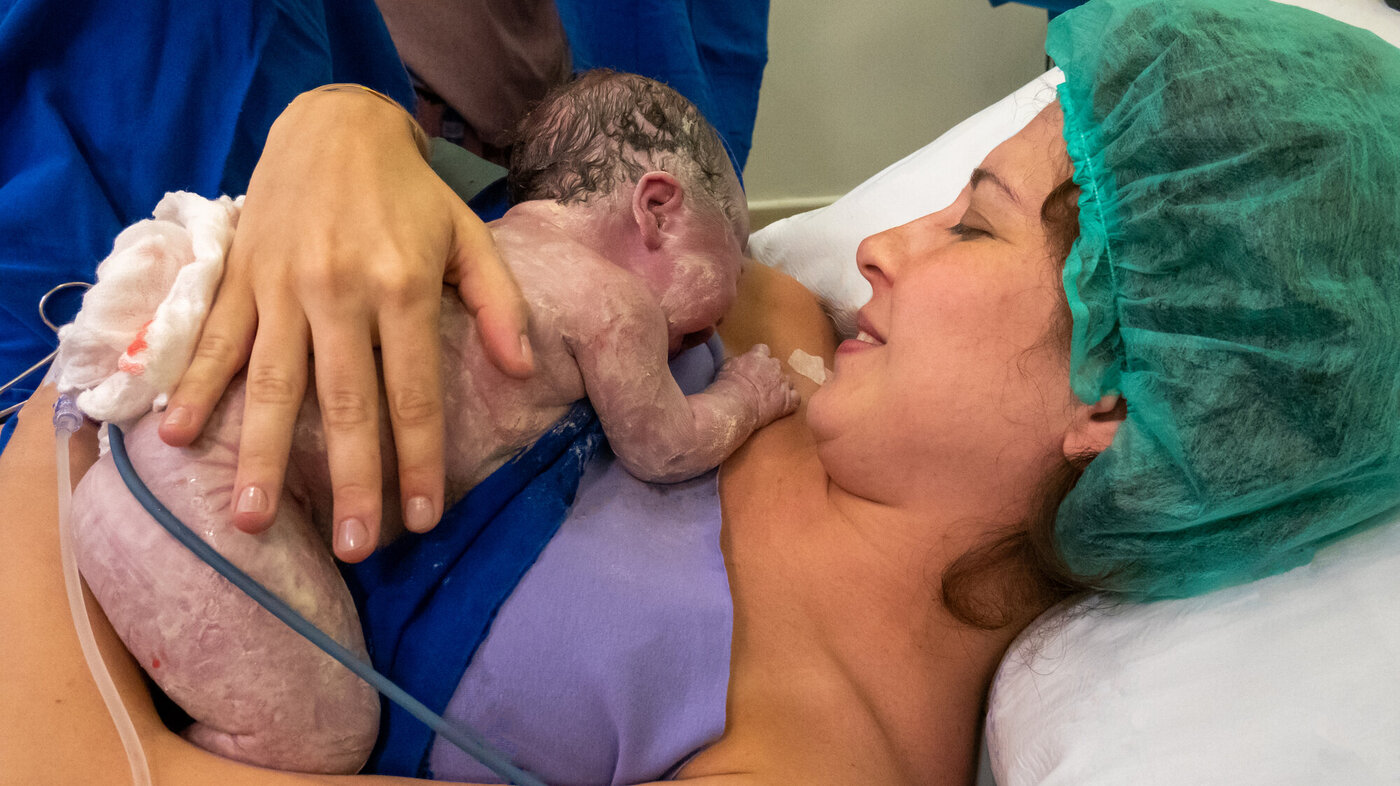 Bildet viser en nyfødt baby som ligger på brystet til moren