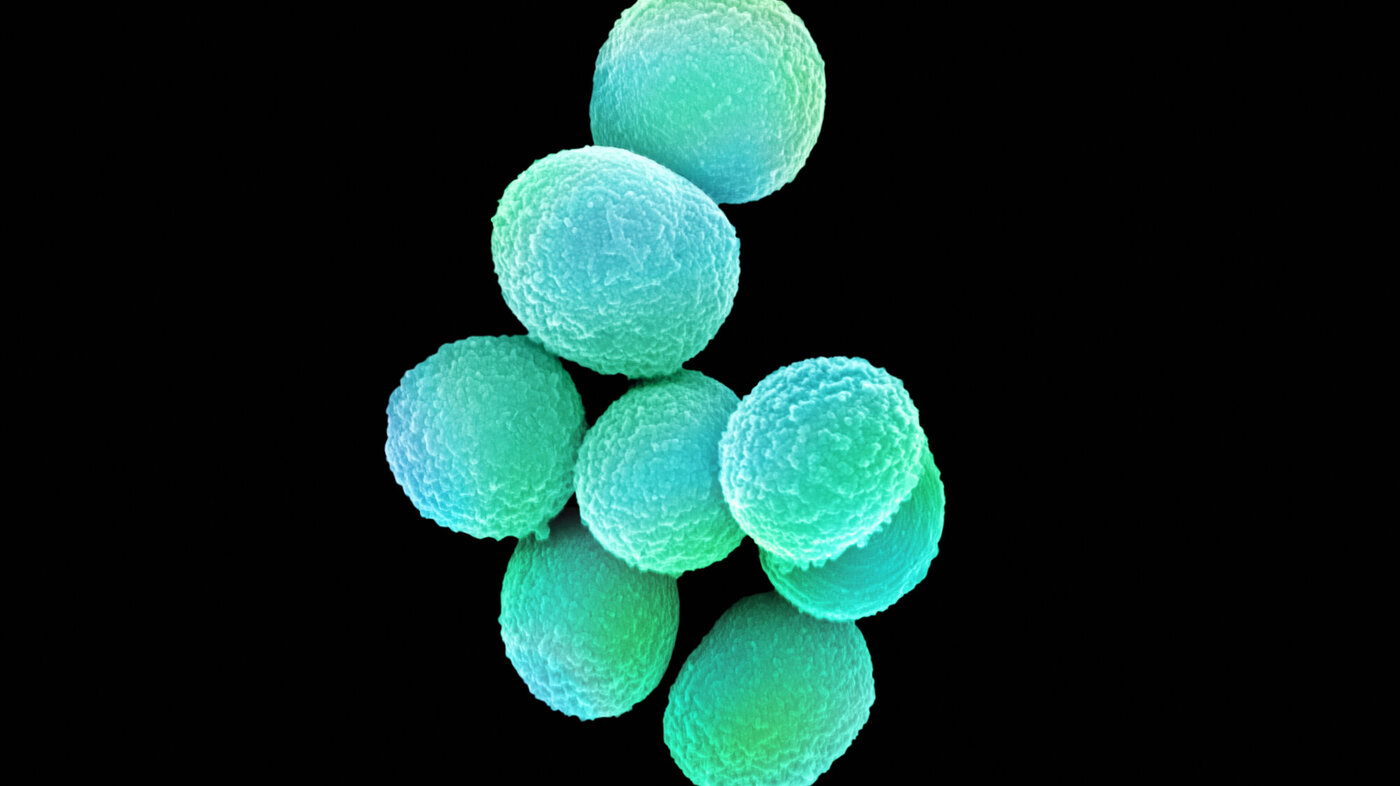 Bildet viser  MRSA (meticillin­resistente gule stafylokokker).