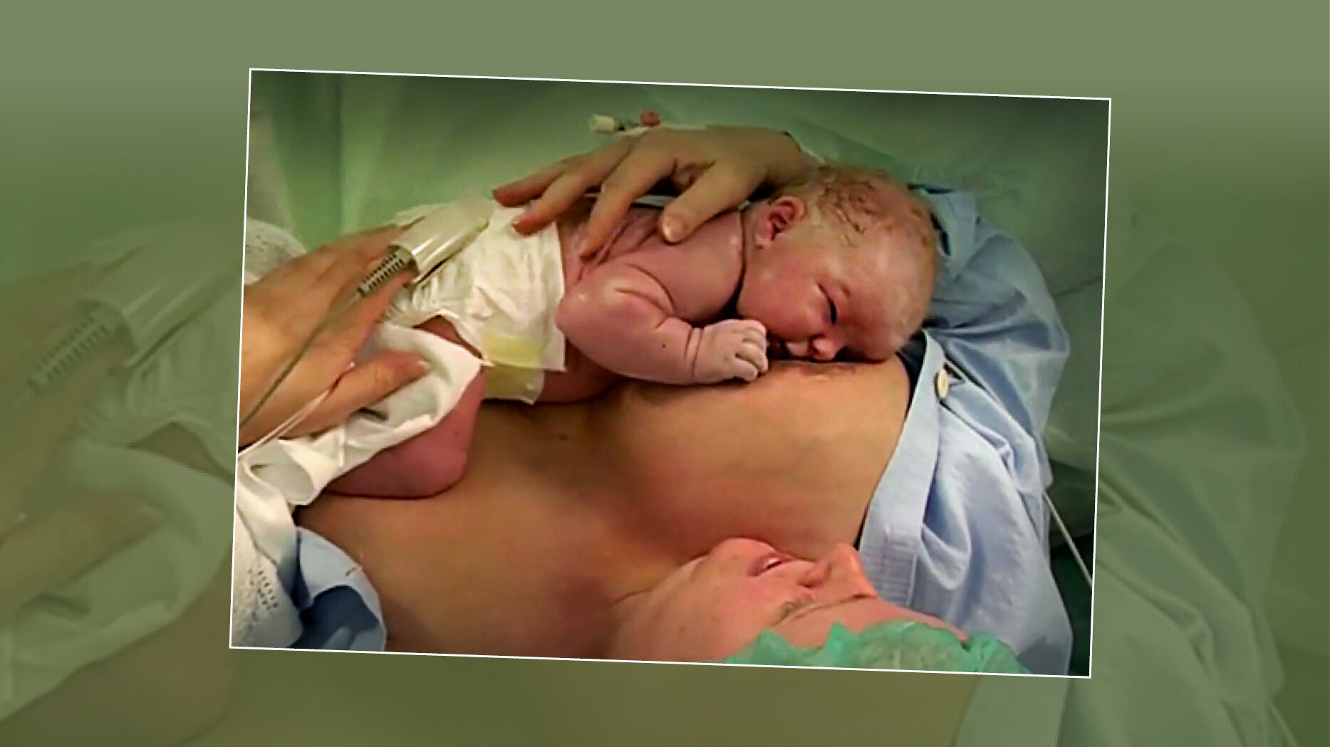 Nyfødt baby som ammes Bildet viser en nyfødt baby som ligger på brystet til moren og ammes