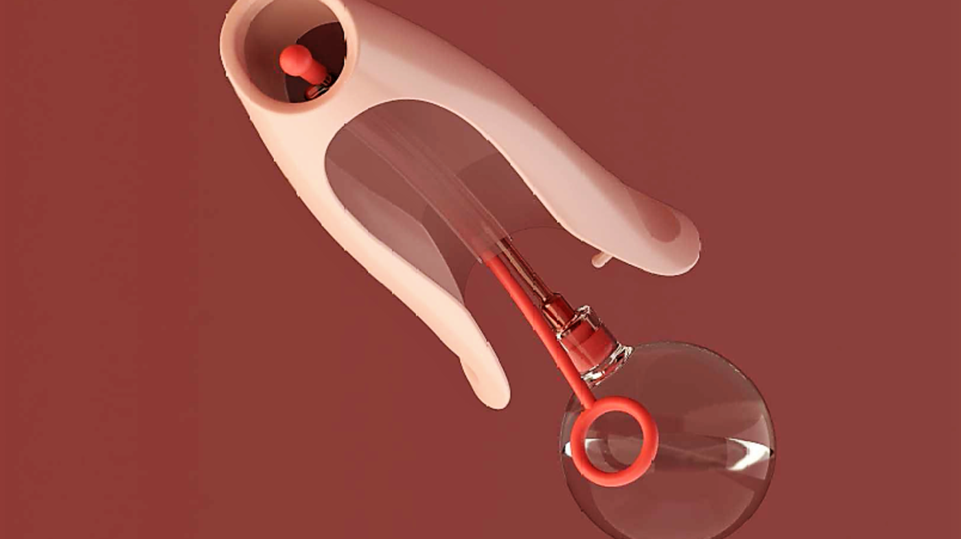 Prototype av spekulum med ballongkateter. Prototype av spekulum med ballongkateter.