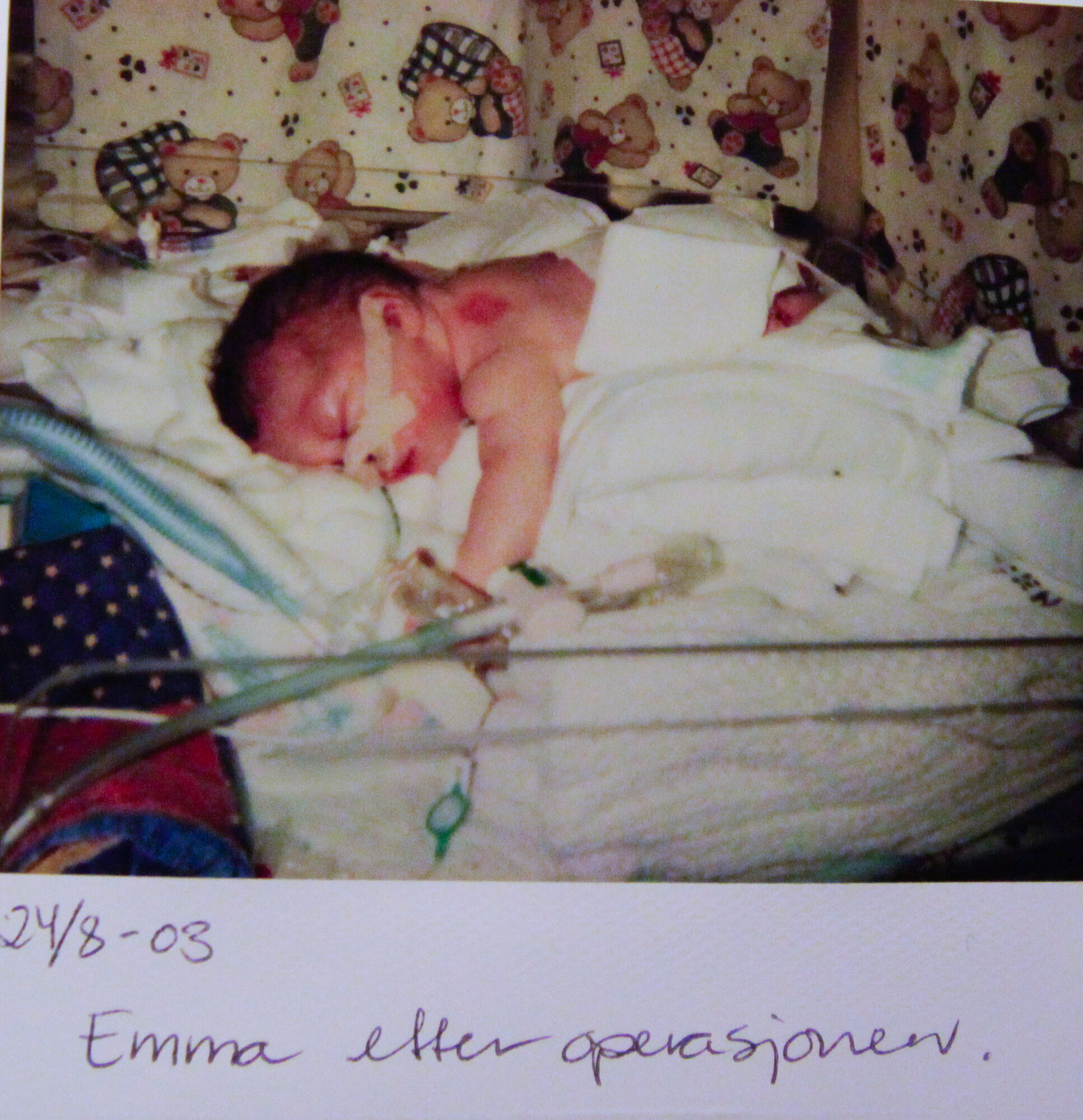 Emma som nyfødt og nyoperert bildet viser Emma som nyfødt og nyoperert