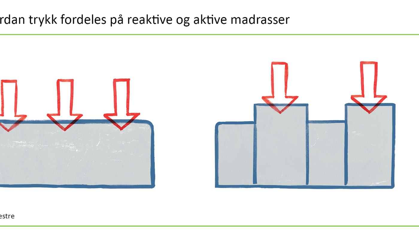 Figur 2. Hvordan trykk fordeles på reaktive og aktive madrasser