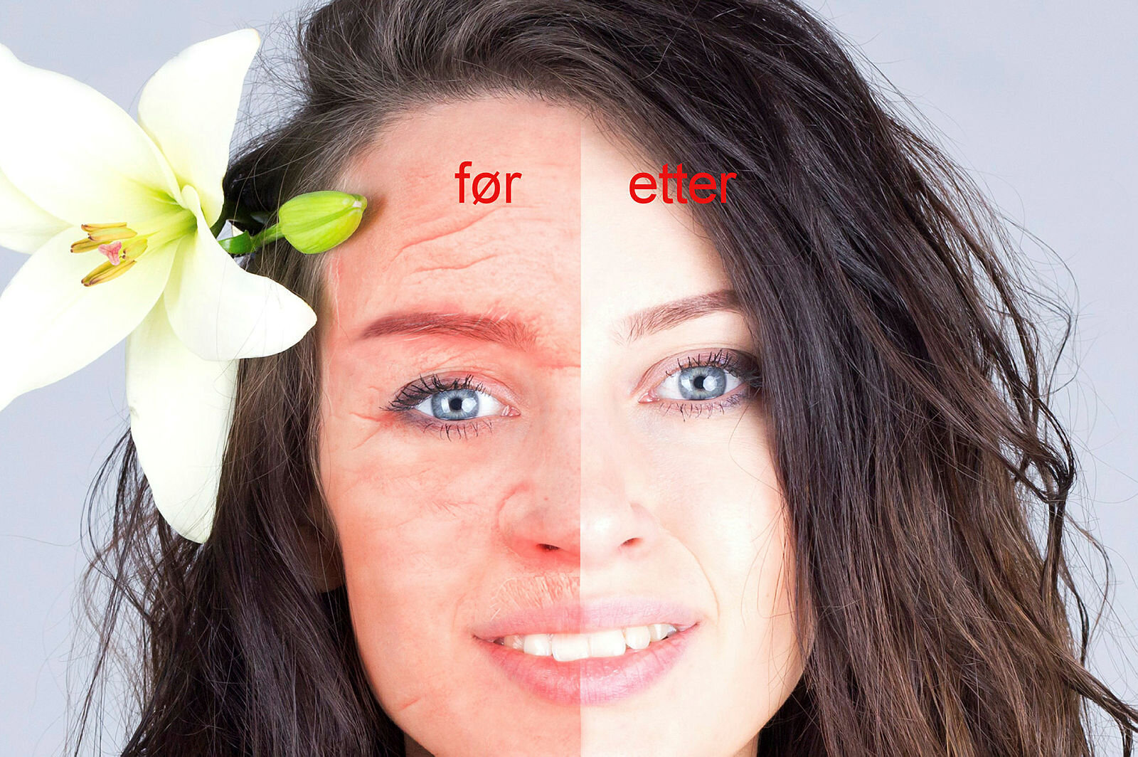 Før og etter Før og etter