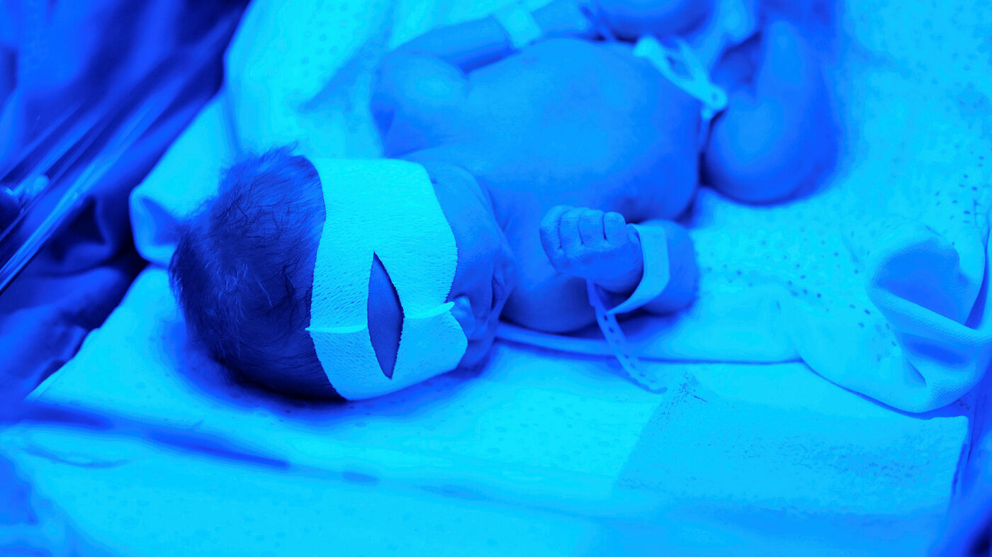 Bildet viser en nyfødt baby som ligger i en lyskasse og får lysterapi mot gulsott.