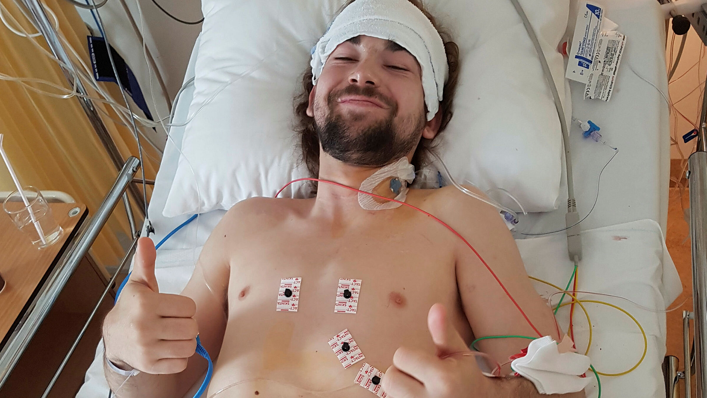 Nikolai Raabye Haugen Nikolai Raabye Haugen fotografert i sykesenga etter sin tredje nyretransplantasjon, sommeren 2018.