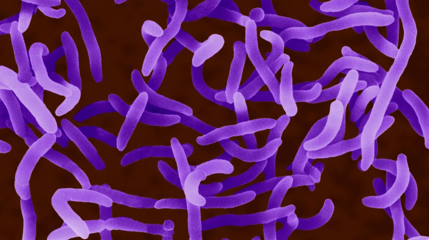 Bildet viser vibriobakterien Vibrio cholerae