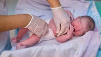 Bildet viser et nyfødt barn som får på seg en bleie