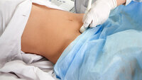 En gravid kvinne får ultralyd