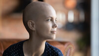 Bildet viser en ung kvinne uten hår, som antyder at hun får behandling for kreft