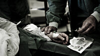 Bildet viser en hånd som holder en kanyle på operasjonsstuen.